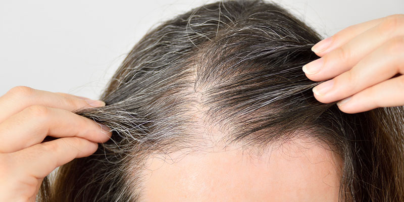 What You Need to Know About Hair Restoration